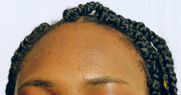 Best trichologists in Essex Stephen James Trichology