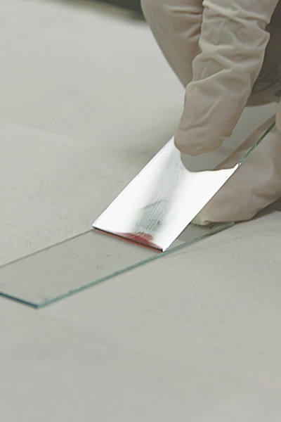 Hair loss blood tests at Stephen James Trichology, Banbury, Oxford, Birmingham