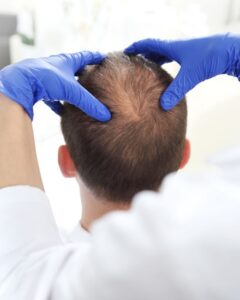 hair loss treatments at Stephen James Trichology in Oxford, Birmingham, Saffron Walden