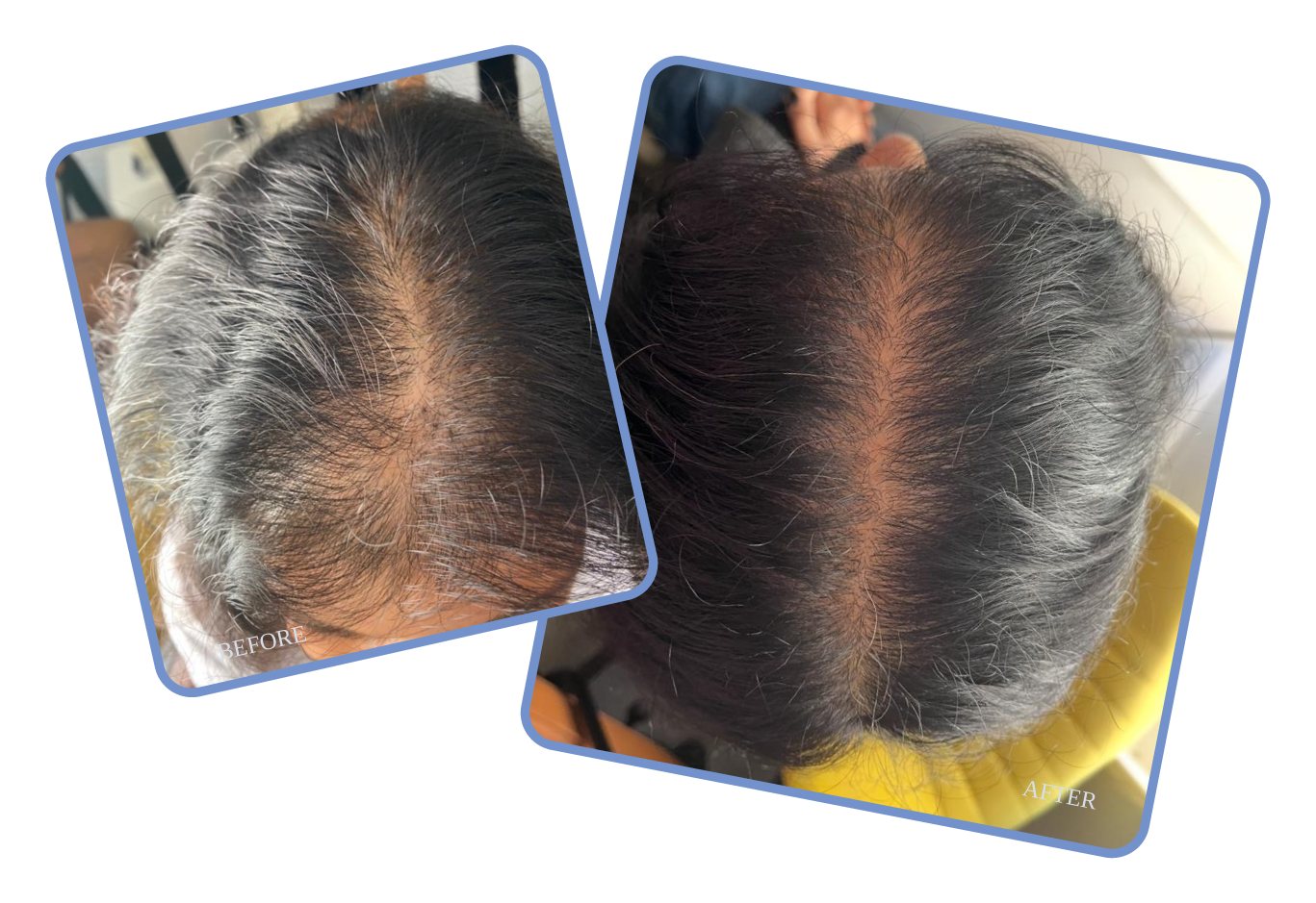 hair loss solutions at Stephen James Trichology - Oxford, Saffron Walden, Birmingham